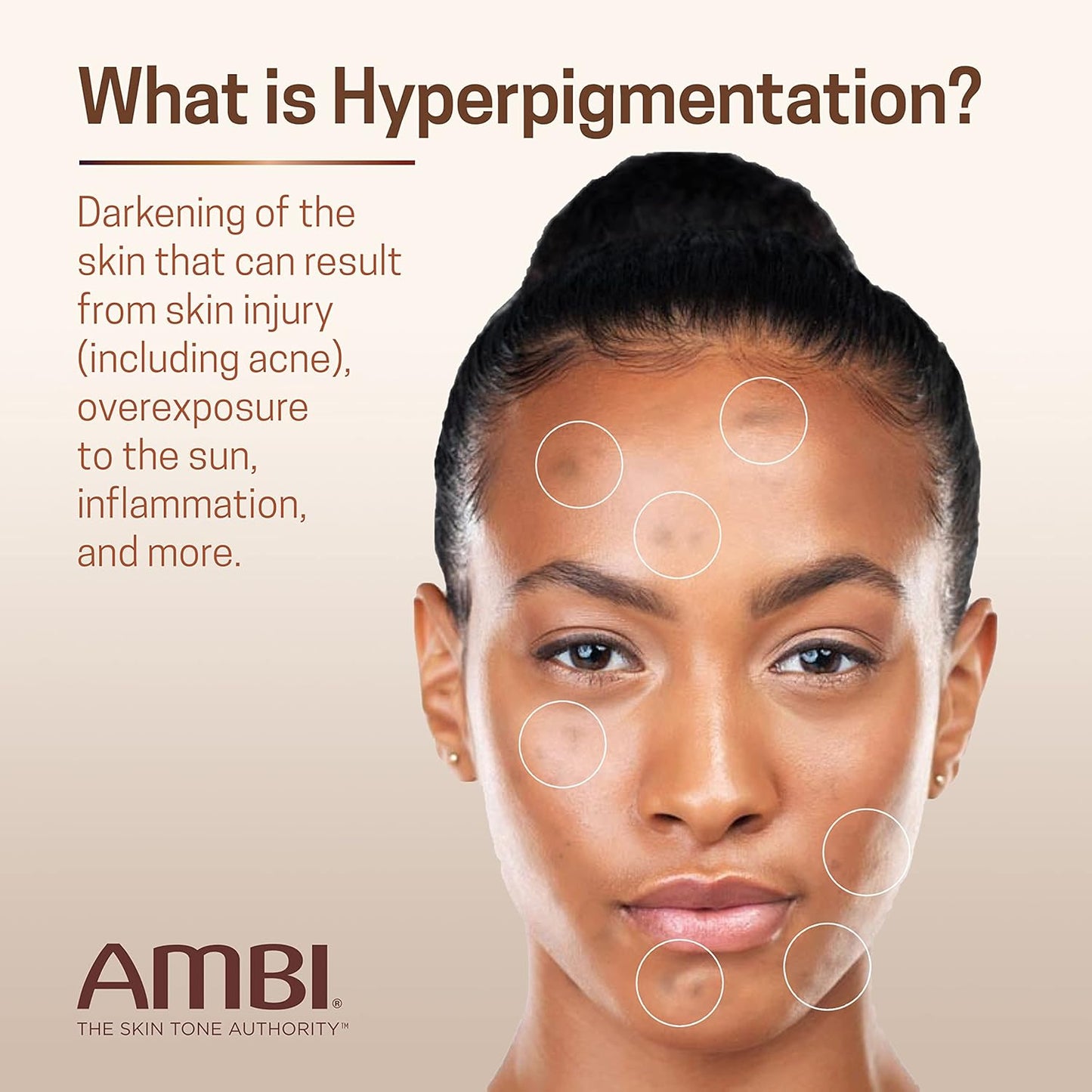 Ambi Even & Clear Advanced Fade Cream, Hydroquinone-free, Hyperpigmentation Treatment, Stubborn Dark Spot Corrector, Niacinamide, Licorice Root Extract, PHA, 1 Fl Oz